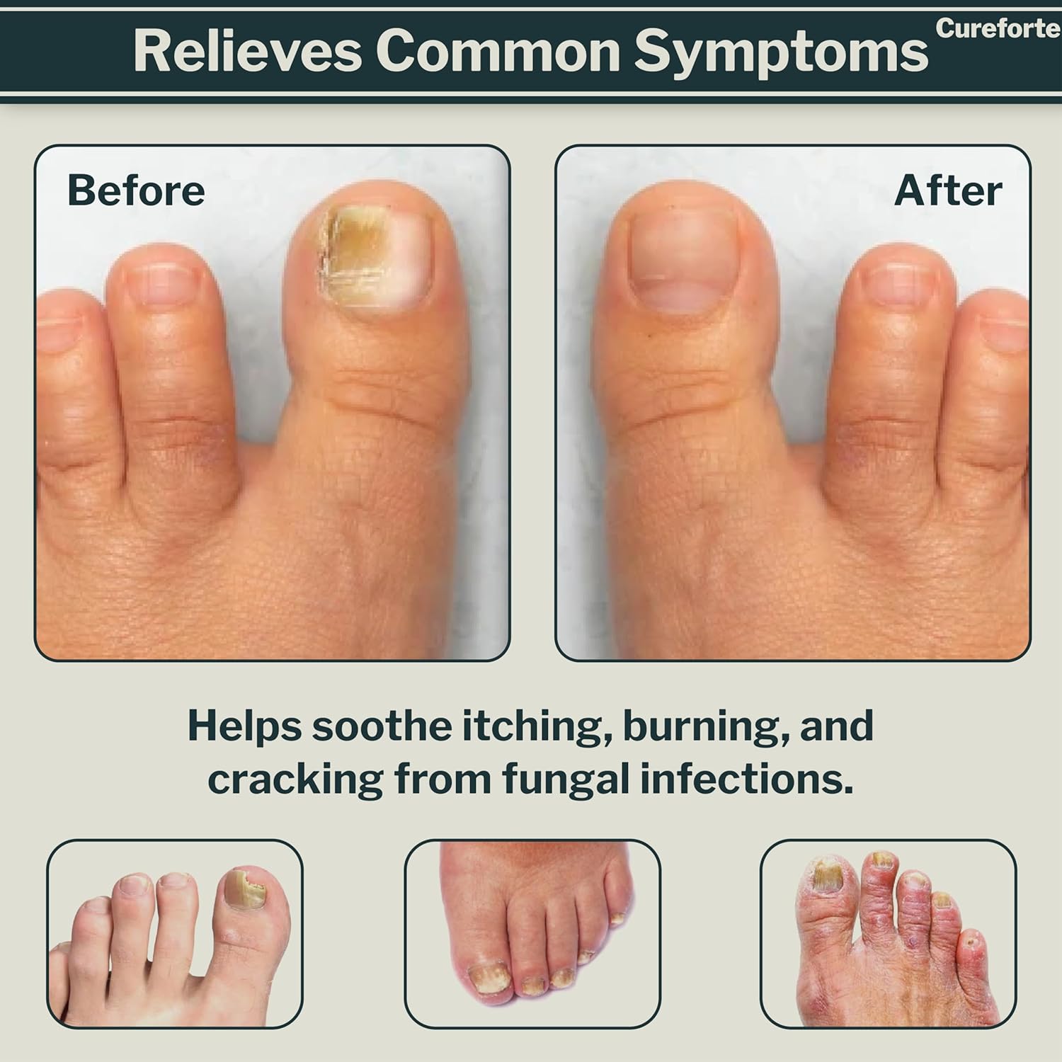 Anti-Fungal Foot Care Serum with Tolnaftate 1% - Image 6